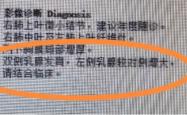 世界杯投注app -32岁男子胸(xiōng)部突然鼓(gǔ)起，感到羞耻和无比焦虑，一查慌了……