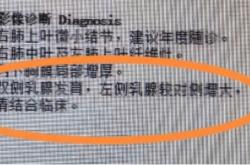 世界杯投注app -32岁男子胸(xiōng)部突然鼓(gǔ)起，感到羞耻和无比焦虑，一查慌了……