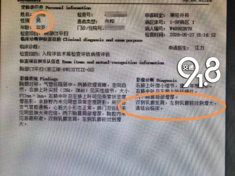 杭州32岁健身小伙以为是增肌 结果是胸部“发育” 医生：病根藏在大脑里