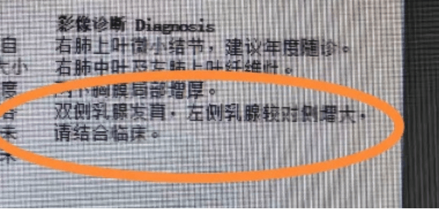 32岁男子胸部突然鼓起，感到羞耻和无比焦虑，一查慌了……